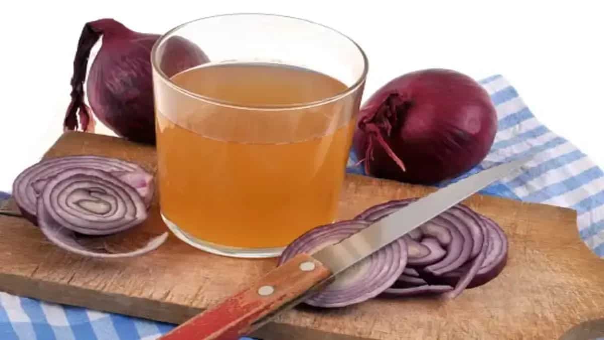 5 Benefits Of Onion Juice For Hair: Know How To Apply It 